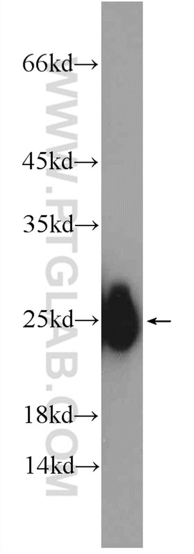 TNNI2 Antibody in Western Blot (WB)