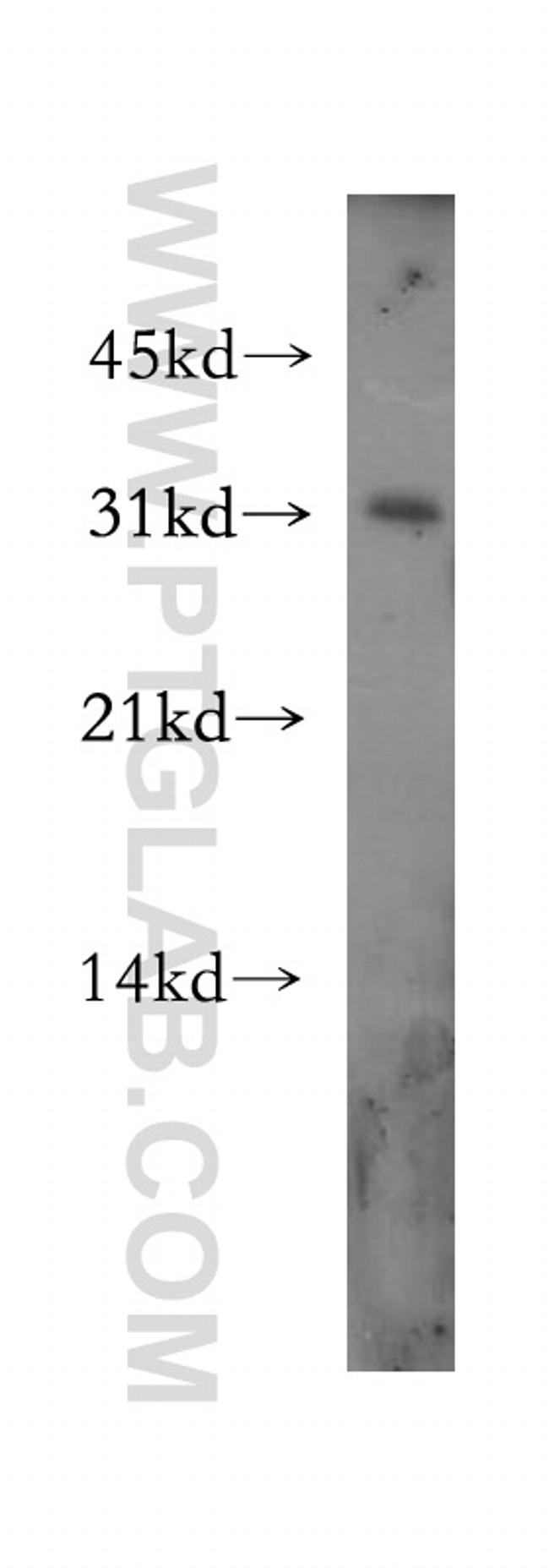 APH1A Antibody in Western Blot (WB)