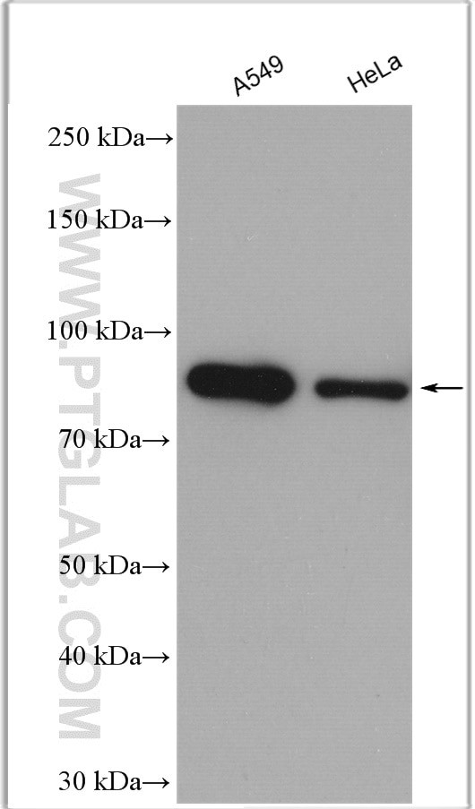 Gelsolin Antibody in Western Blot (WB)