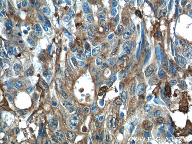 Gelsolin Antibody in Immunohistochemistry (Paraffin) (IHC (P))