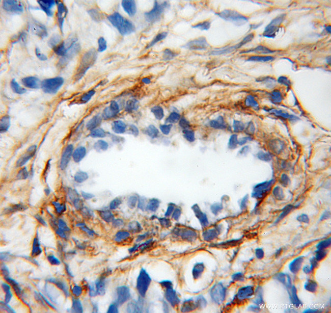 Gelsolin Antibody in Immunohistochemistry (Paraffin) (IHC (P))