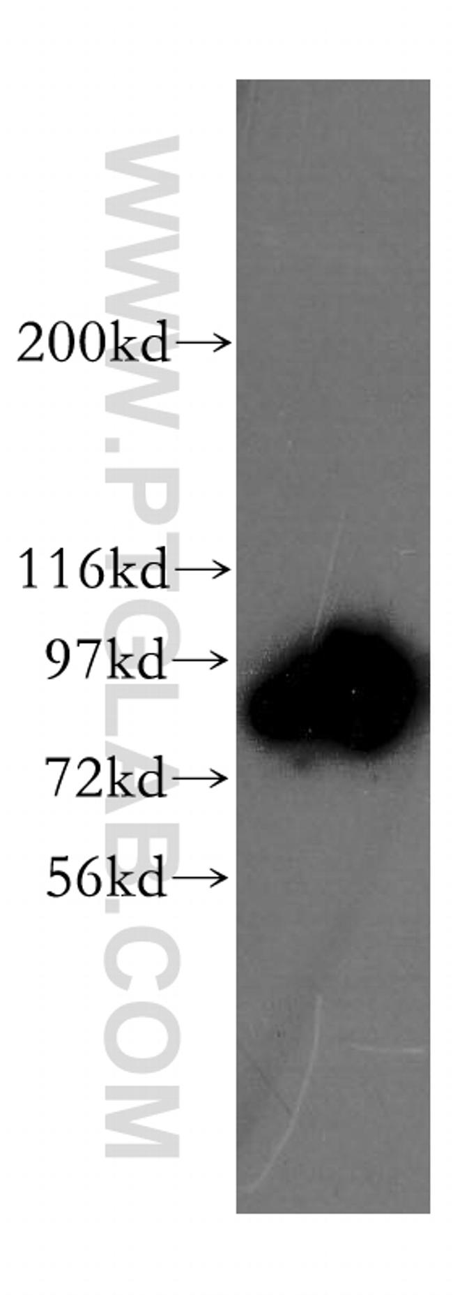 Gelsolin Antibody in Western Blot (WB)