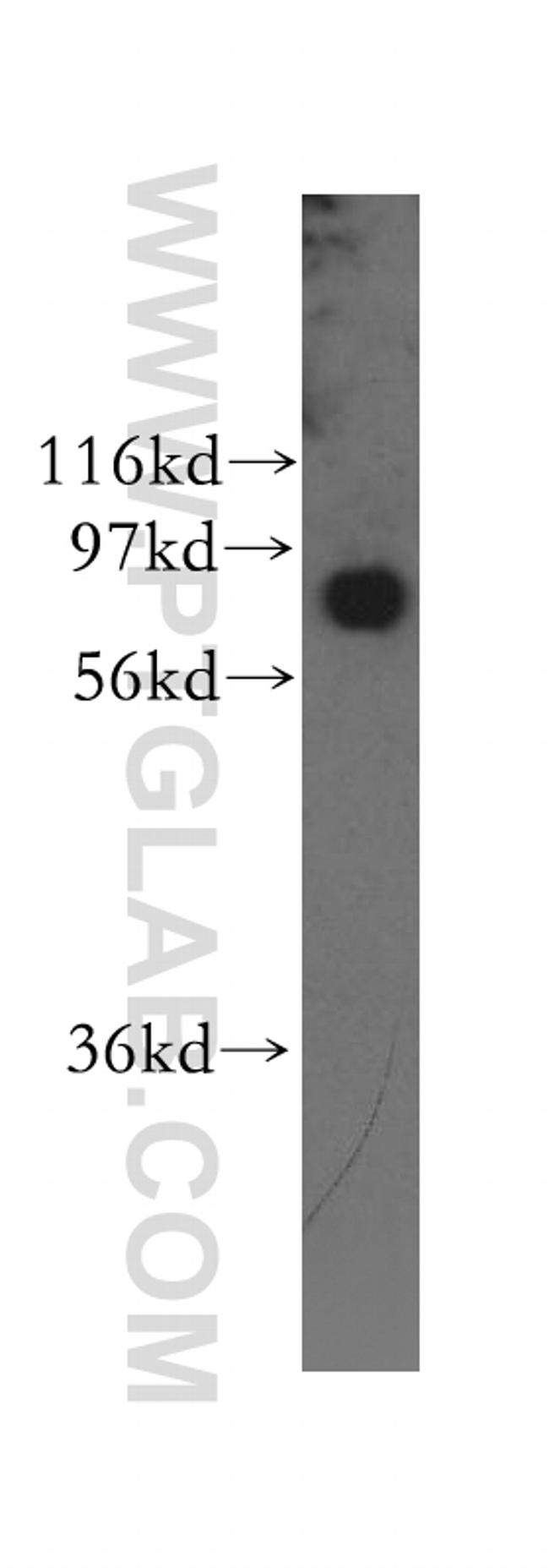 Gelsolin Antibody in Western Blot (WB)