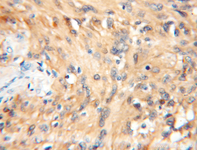 14-3-3 epsilon Antibody in Immunohistochemistry (Paraffin) (IHC (P))