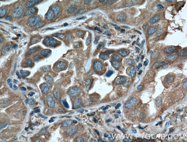 14-3-3 epsilon Antibody in Immunohistochemistry (Paraffin) (IHC (P))