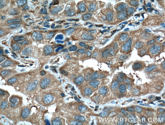 14-3-3 epsilon Antibody in Immunohistochemistry (Paraffin) (IHC (P))