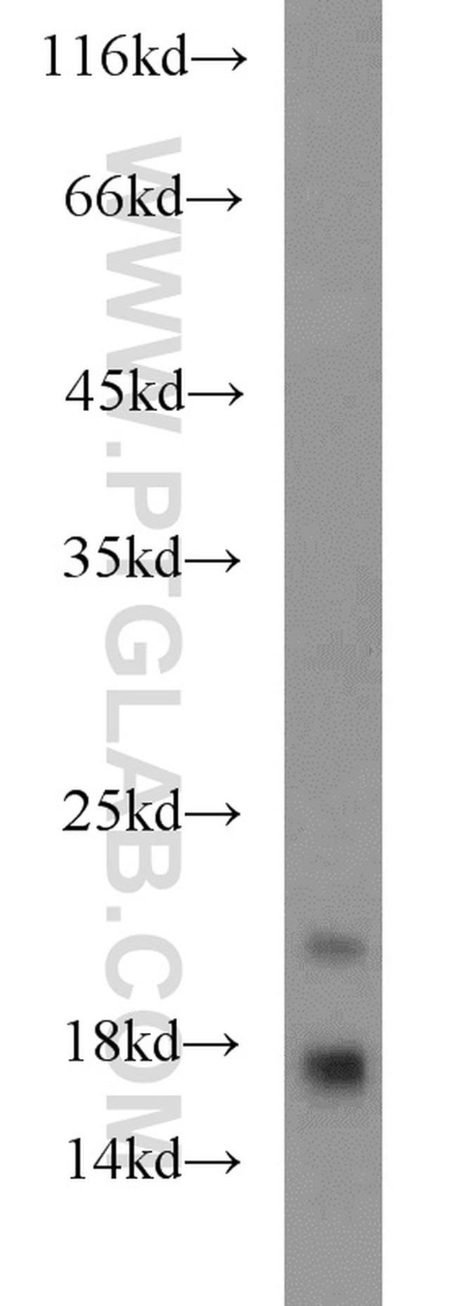 ARPP-19 Antibody in Western Blot (WB)