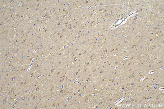 ARPP-19 Antibody in Immunohistochemistry (Paraffin) (IHC (P))