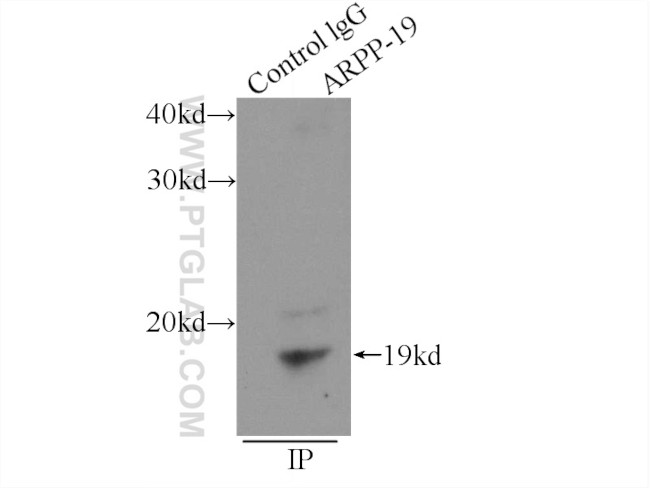 ARPP-19 Antibody in Immunoprecipitation (IP)