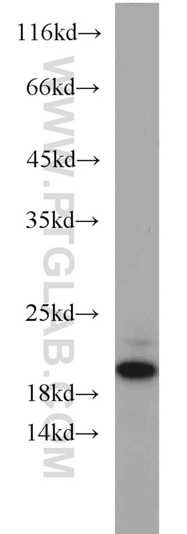 ARPP-19 Antibody in Western Blot (WB)