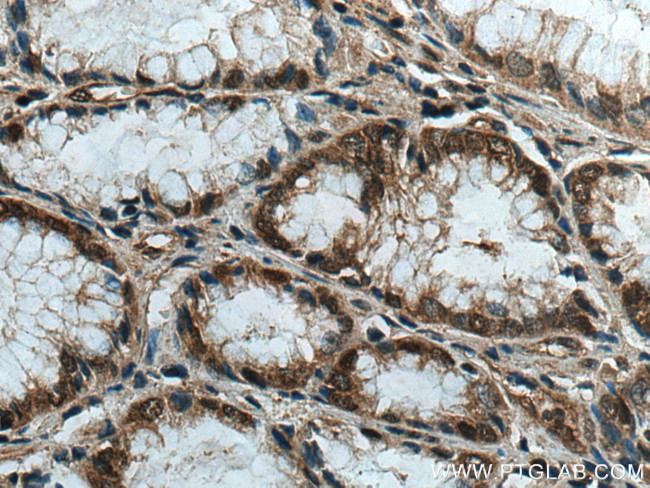 IPO4 Antibody in Immunohistochemistry (Paraffin) (IHC (P))