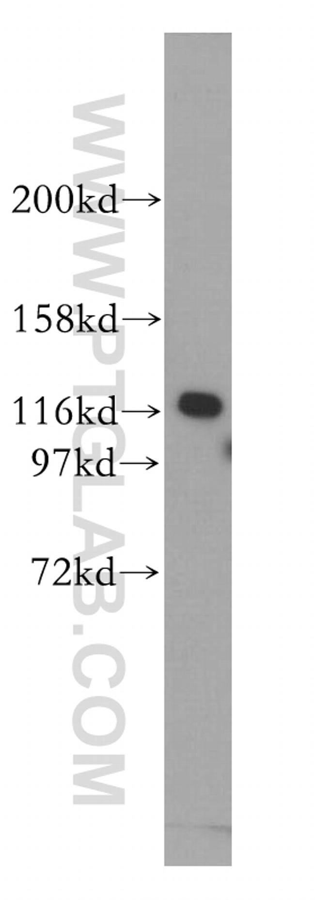 IPO4 Antibody in Western Blot (WB)