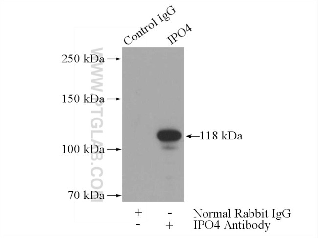 IPO4 Antibody in Immunoprecipitation (IP)