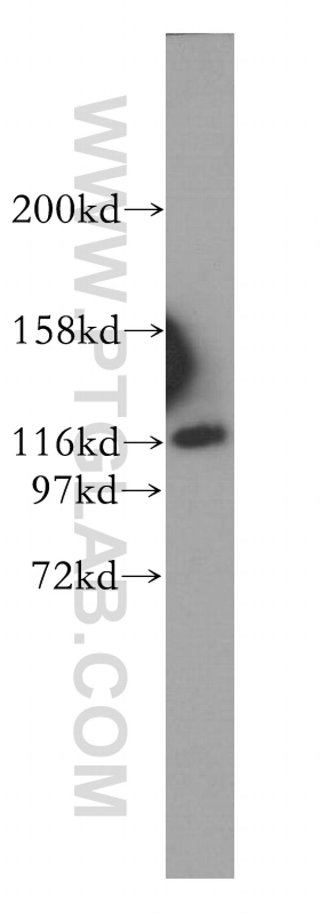 IPO4 Antibody in Western Blot (WB)