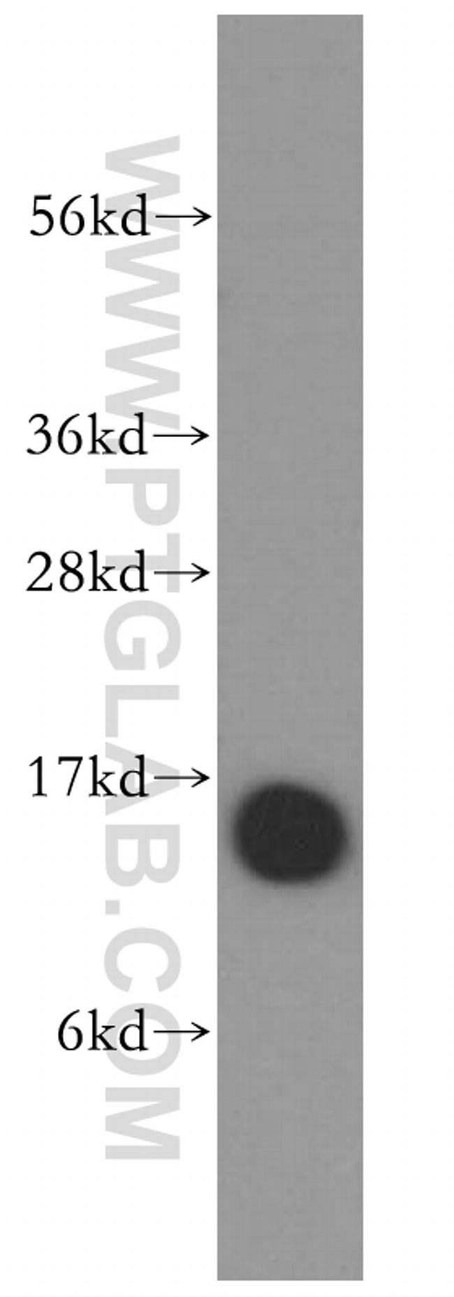 Profilin 1 Antibody in Western Blot (WB)