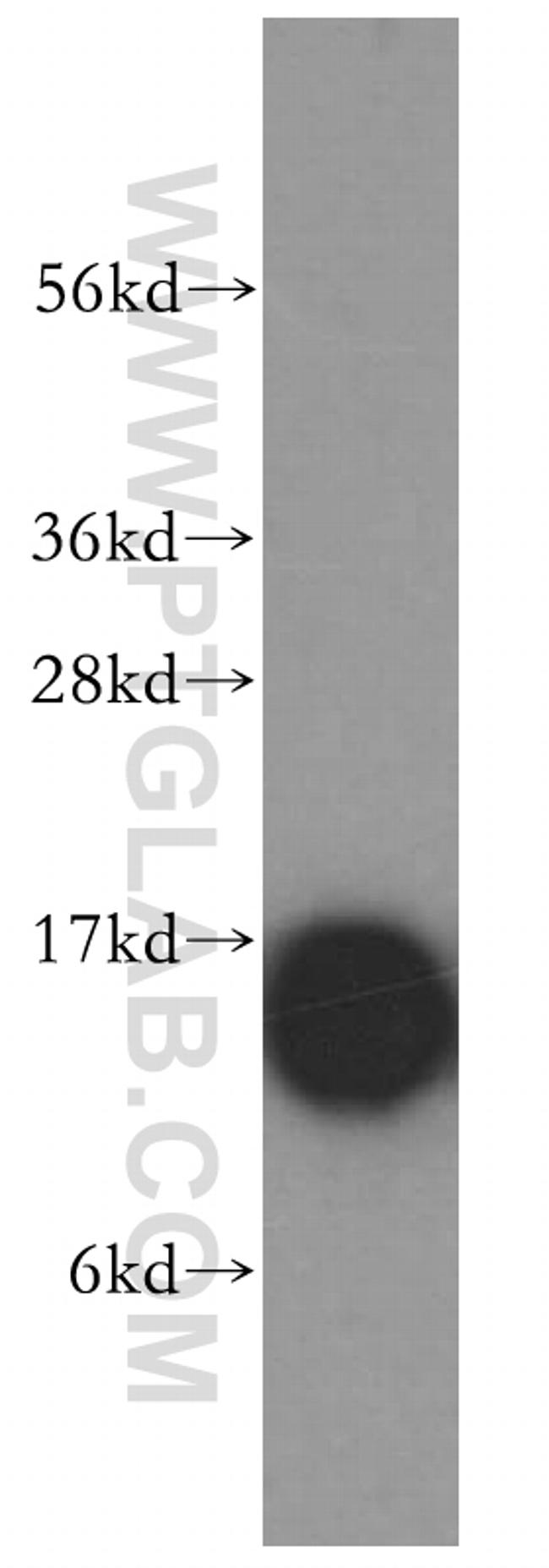 Profilin 1 Antibody in Western Blot (WB)