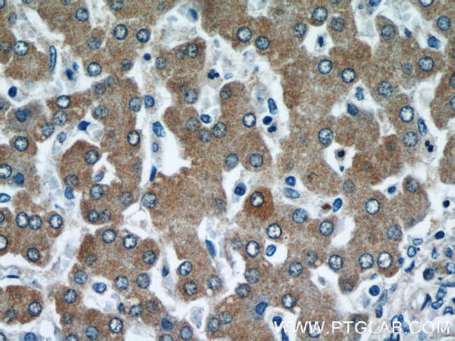 CYP4A11 Antibody in Immunohistochemistry (Paraffin) (IHC (P))