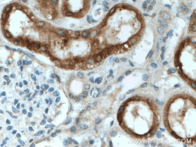 CYP4A11 Antibody in Immunohistochemistry (Paraffin) (IHC (P))