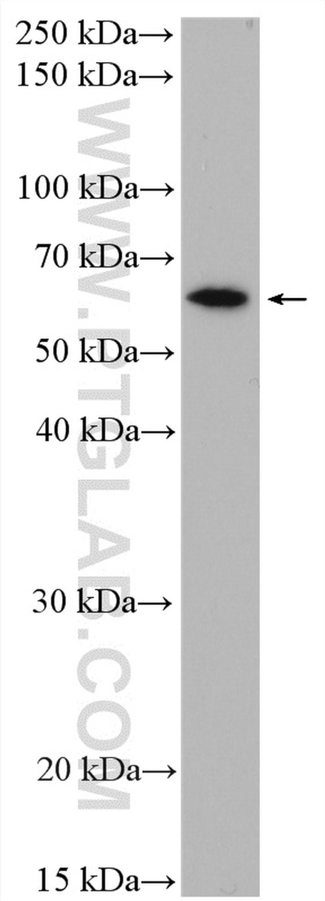 CYP4A11 Antibody in Western Blot (WB)