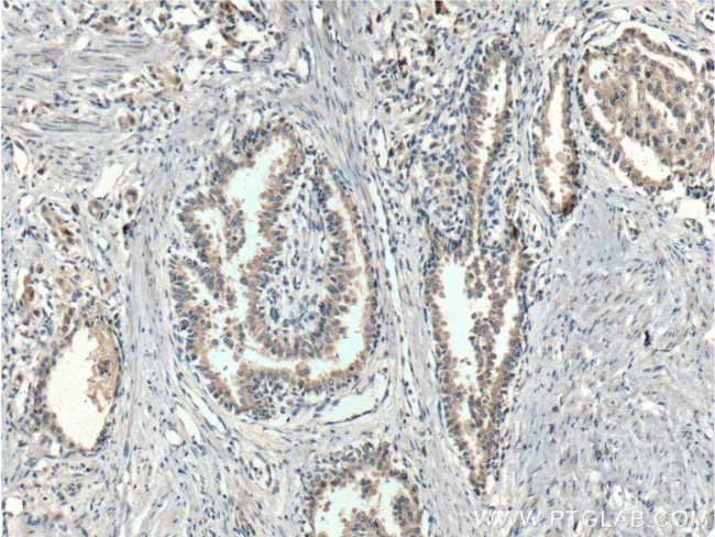 FKBP2 Antibody in Immunohistochemistry (Paraffin) (IHC (P))