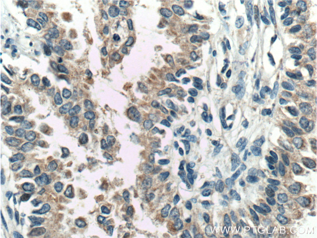 FKBP2 Antibody in Immunohistochemistry (Paraffin) (IHC (P))