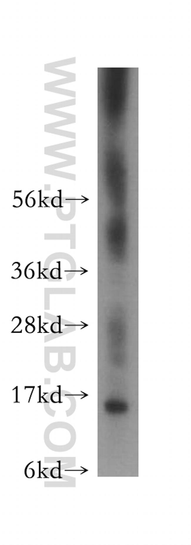 FKBP2 Antibody in Western Blot (WB)