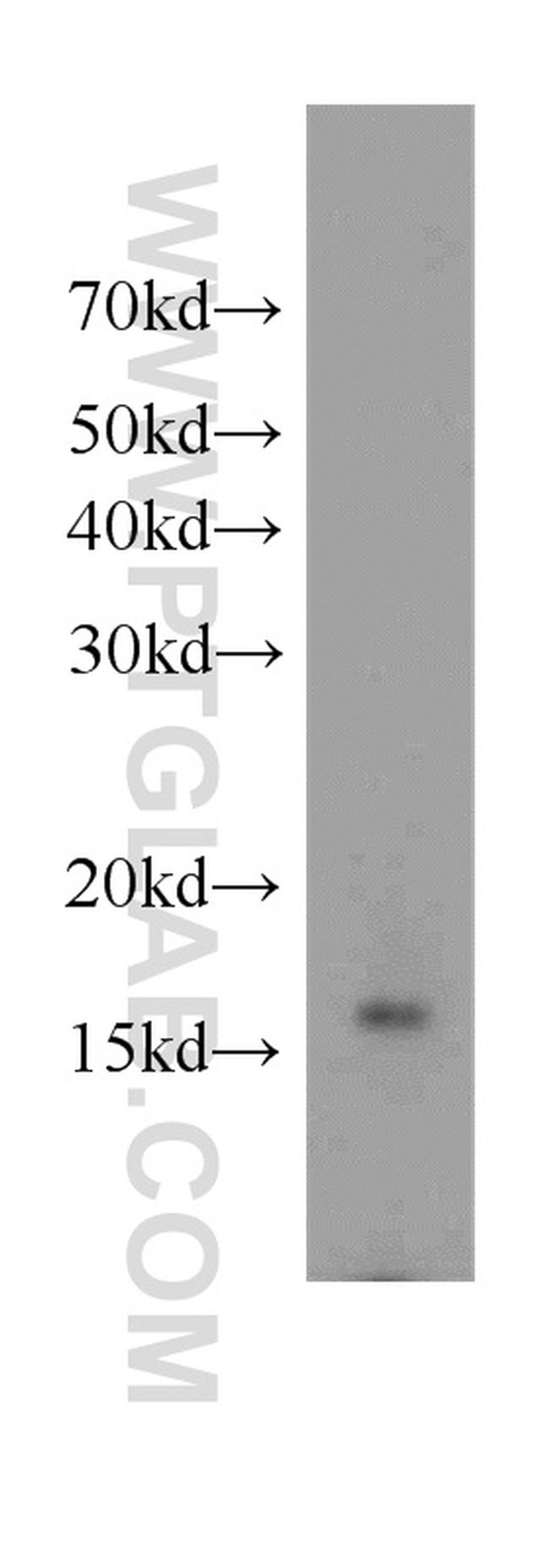 FKBP2 Antibody in Western Blot (WB)