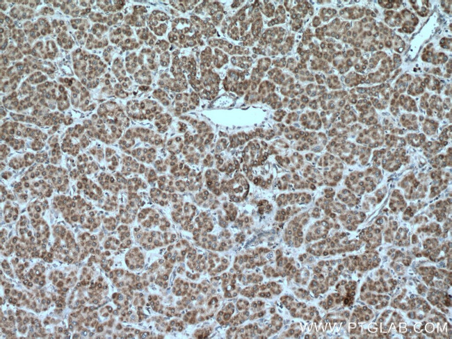 MRPL23 Antibody in Immunohistochemistry (Paraffin) (IHC (P))