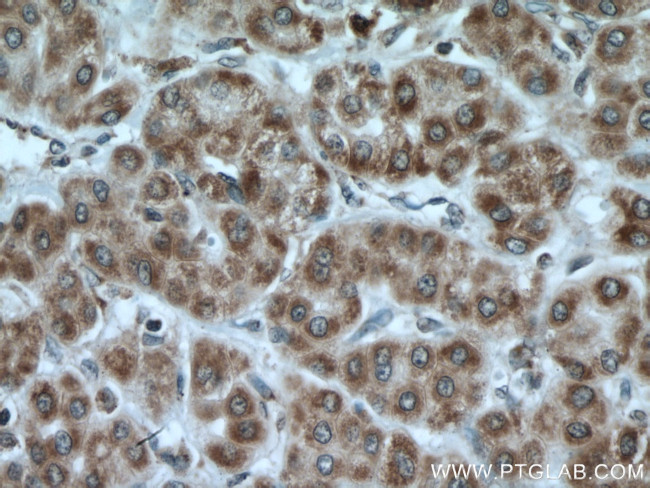 MRPL23 Antibody in Immunohistochemistry (Paraffin) (IHC (P))