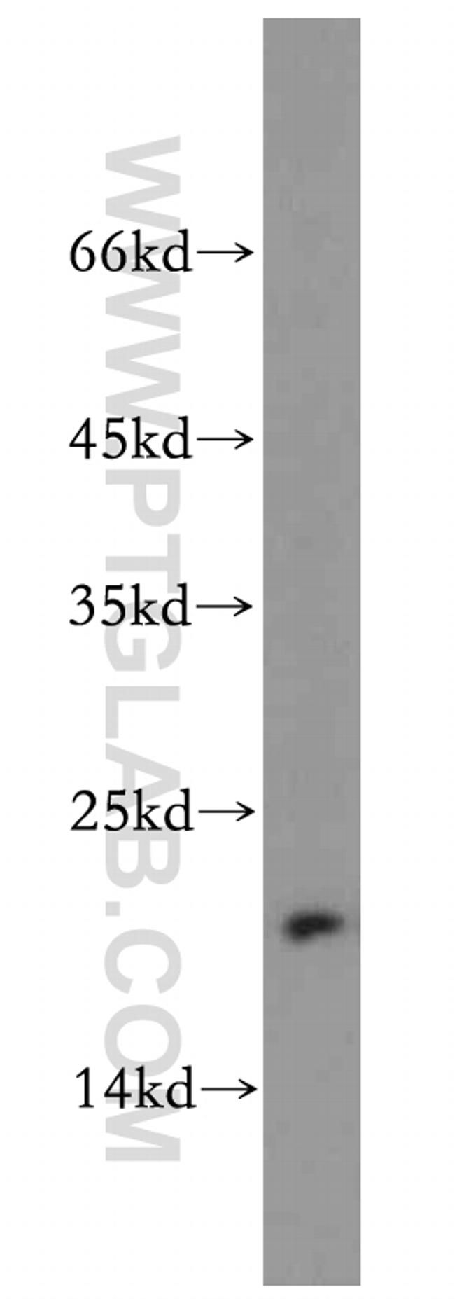 MRPL23 Antibody in Western Blot (WB)