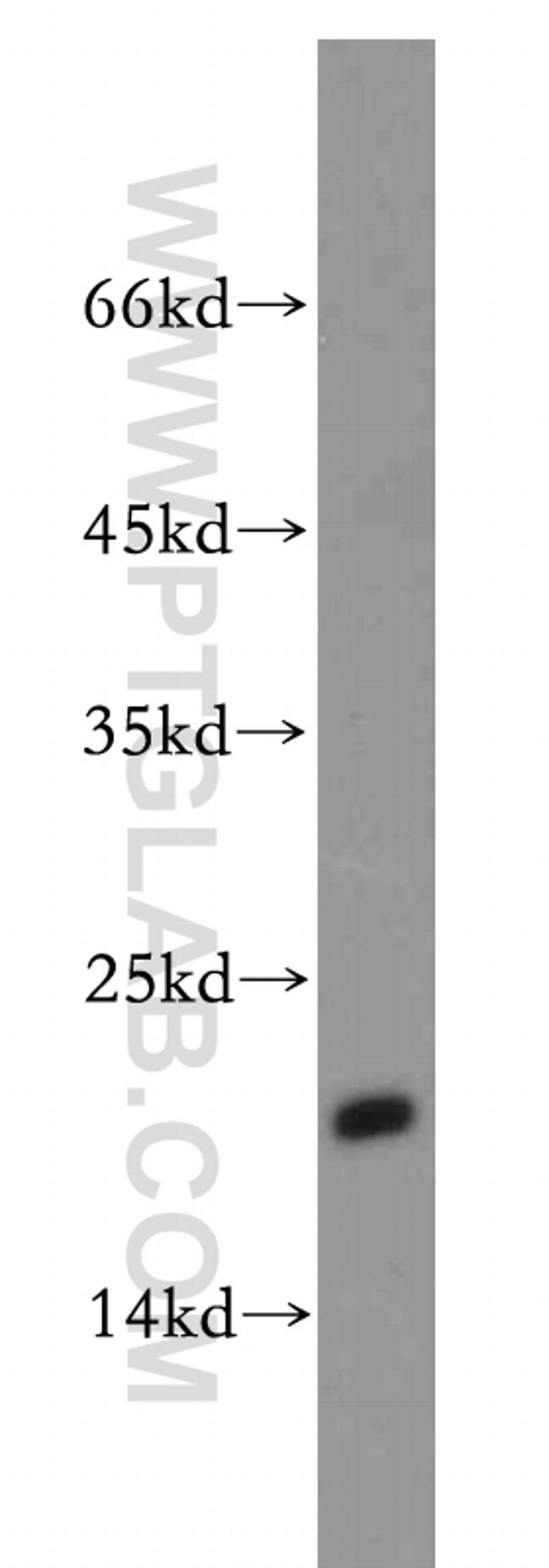 MRPL23 Antibody in Western Blot (WB)