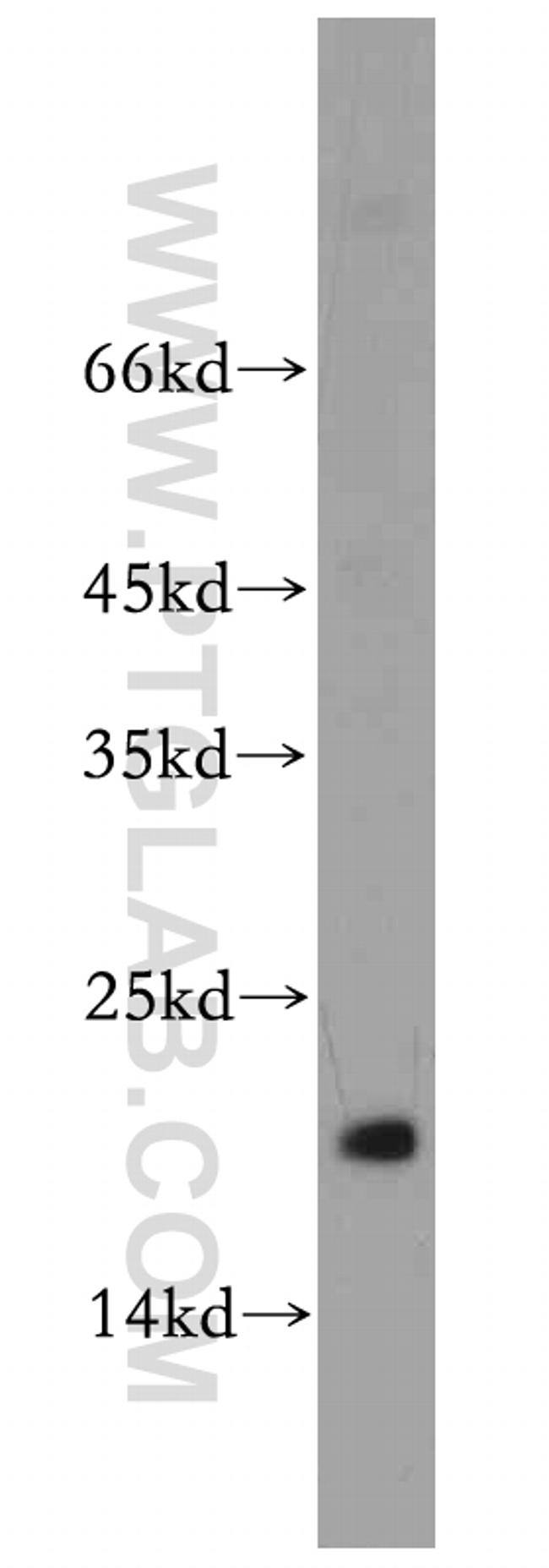 MRPL23 Antibody in Western Blot (WB)