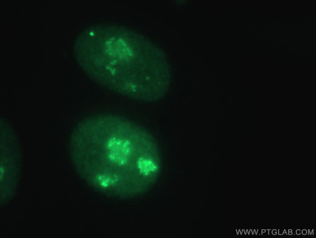 GAR1 Antibody in Immunocytochemistry (ICC/IF)