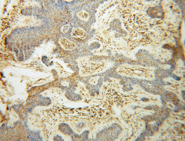 GAR1 Antibody in Immunohistochemistry (Paraffin) (IHC (P))