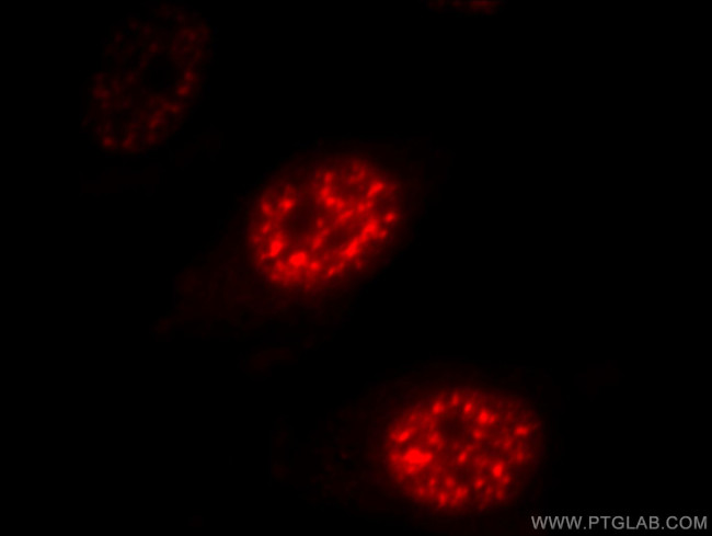 DDX39A Antibody in Immunocytochemistry (ICC/IF)