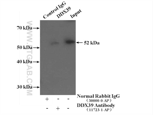 DDX39A Antibody in Immunoprecipitation (IP)