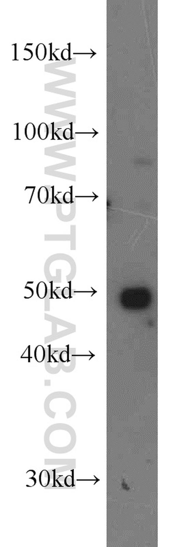 DDX39A Antibody in Western Blot (WB)