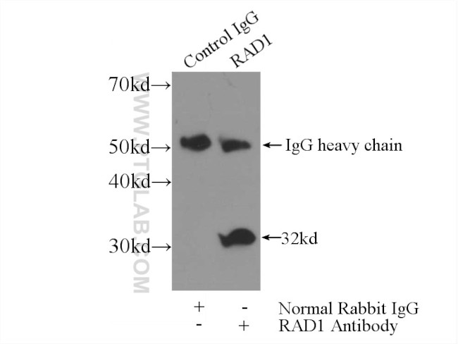 RAD1 Antibody in Immunoprecipitation (IP)