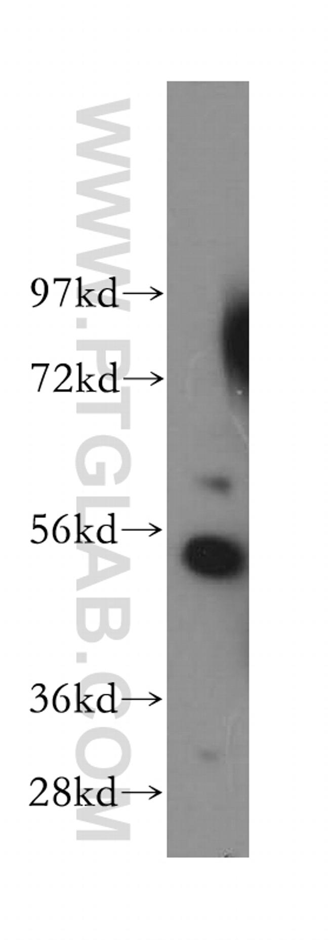 SRP54 Antibody in Western Blot (WB)