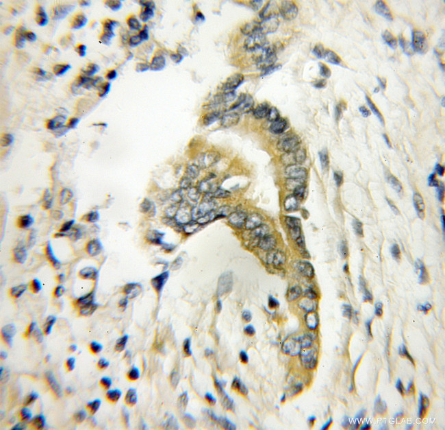 TWF1 Antibody in Immunohistochemistry (Paraffin) (IHC (P))