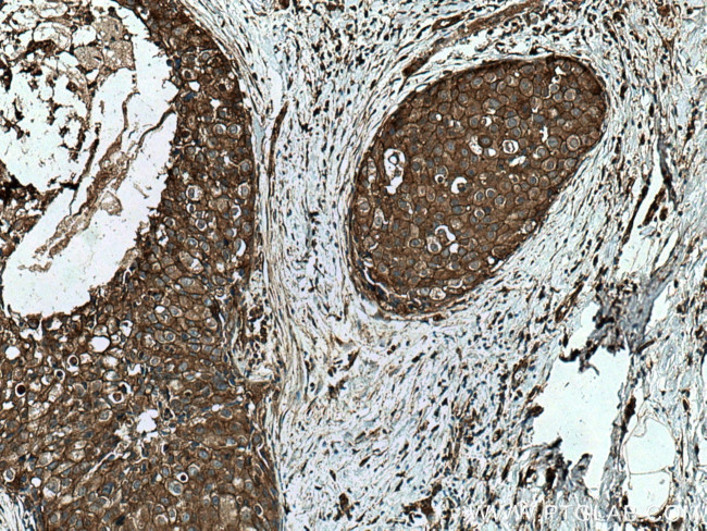 TWF1 Antibody in Immunohistochemistry (Paraffin) (IHC (P))