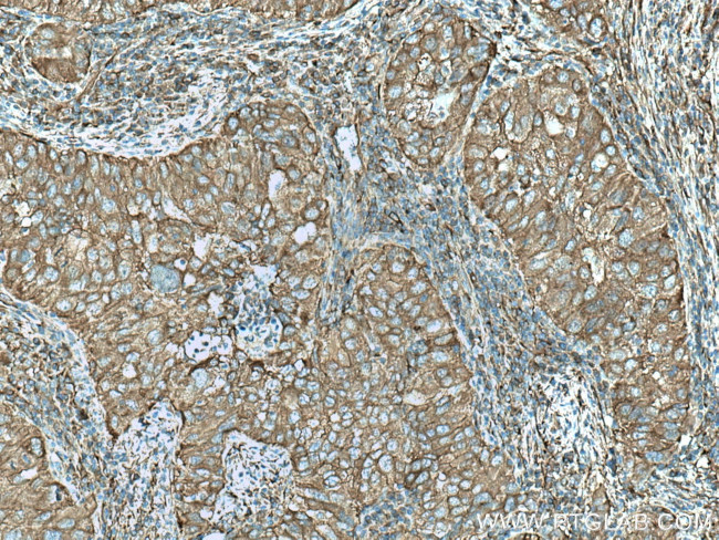 TWF1 Antibody in Immunohistochemistry (Paraffin) (IHC (P))