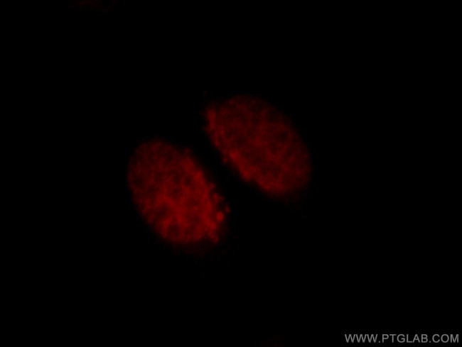 CUX1/Protein CASP Antibody in Immunocytochemistry (ICC/IF)