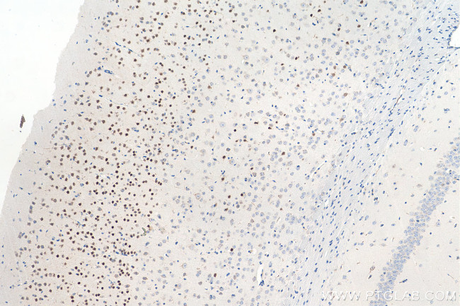 CUX1/Protein CASP Antibody in Immunohistochemistry (Paraffin) (IHC (P))