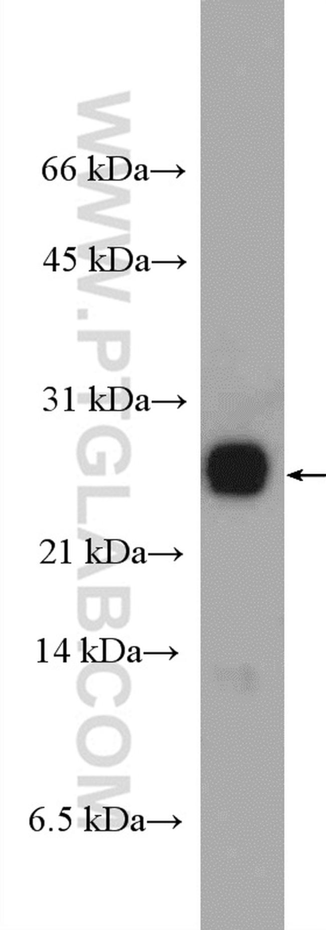 RAB2B Antibody in Western Blot (WB)