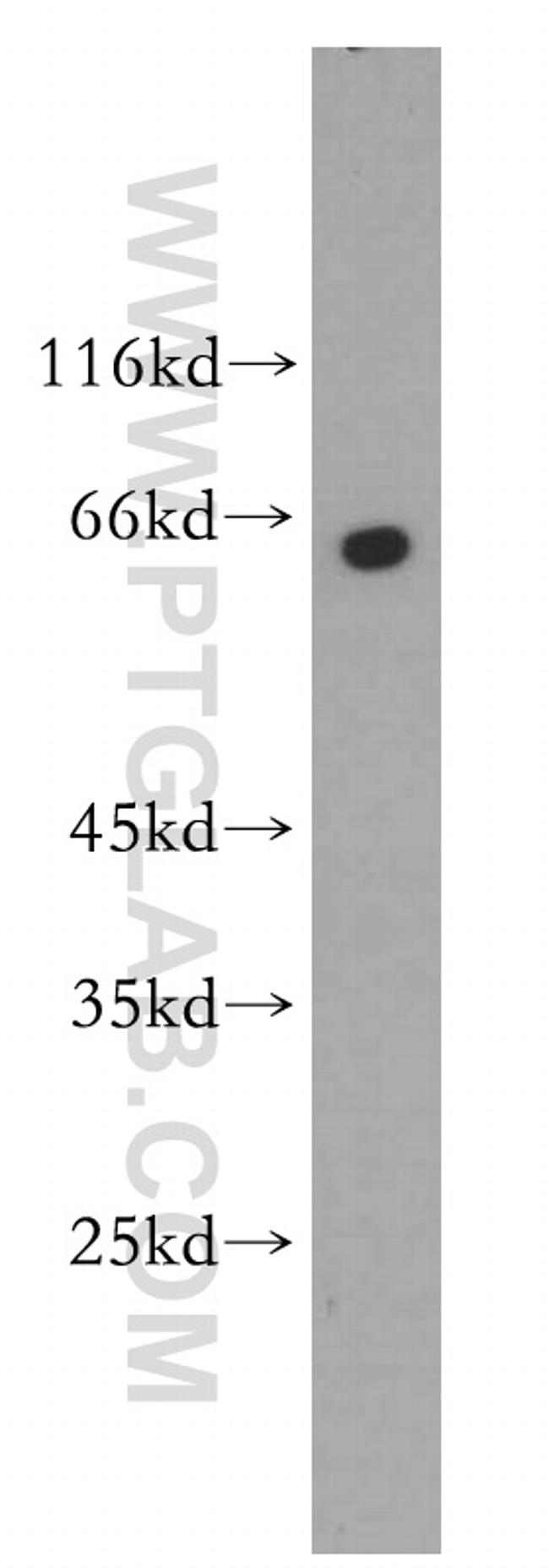 PANK1 Antibody in Western Blot (WB)