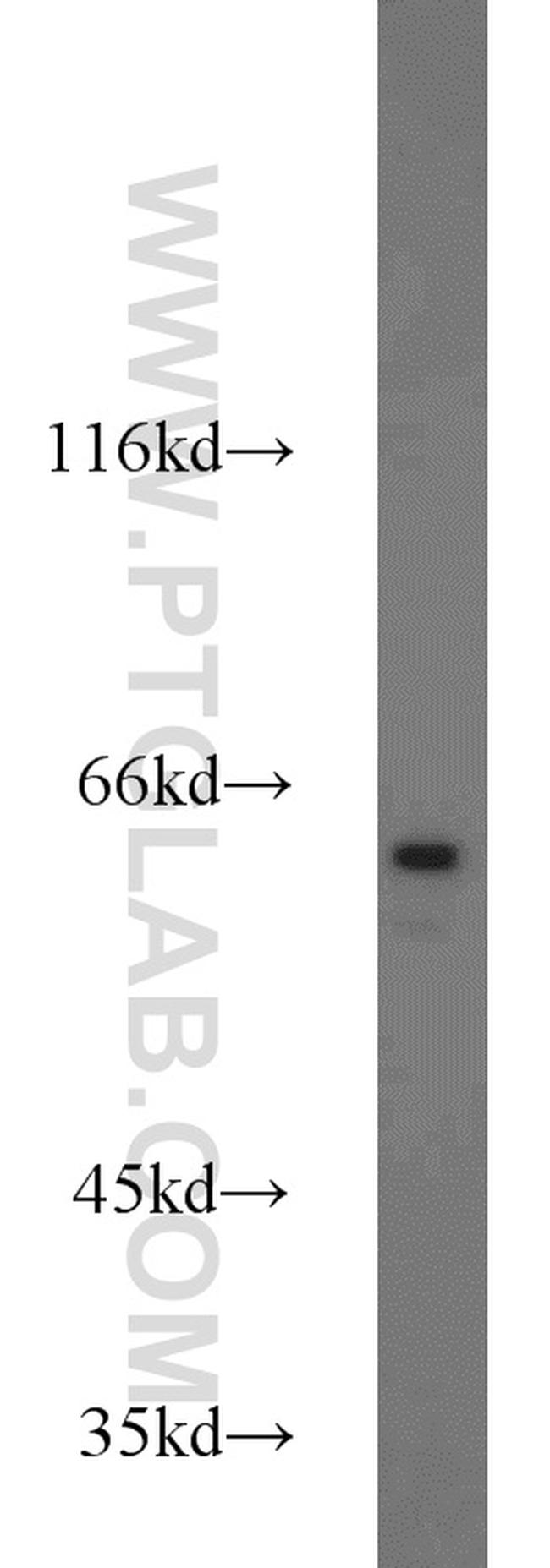 NFIL3 Antibody in Western Blot (WB)