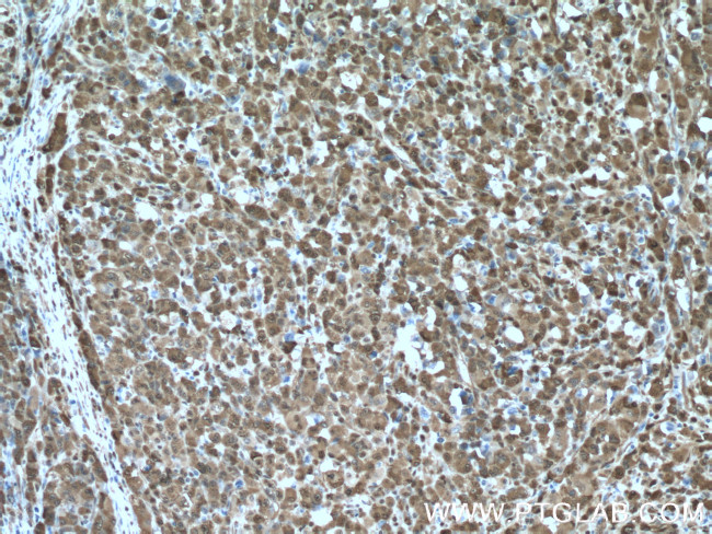 NAMPT/PBEF Antibody in Immunohistochemistry (Paraffin) (IHC (P))