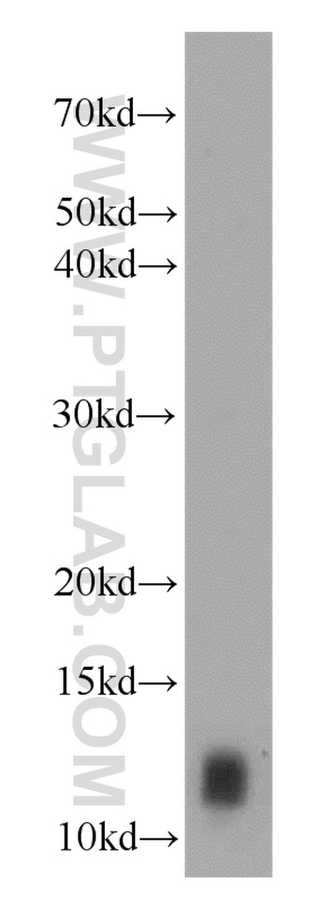 IgG light chain (Kappa) Antibody in Western Blot (WB)