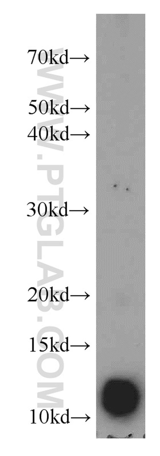 IgG light chain (Kappa) Antibody in Western Blot (WB)